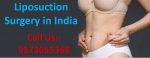 Cost of Liposuction Surgery India